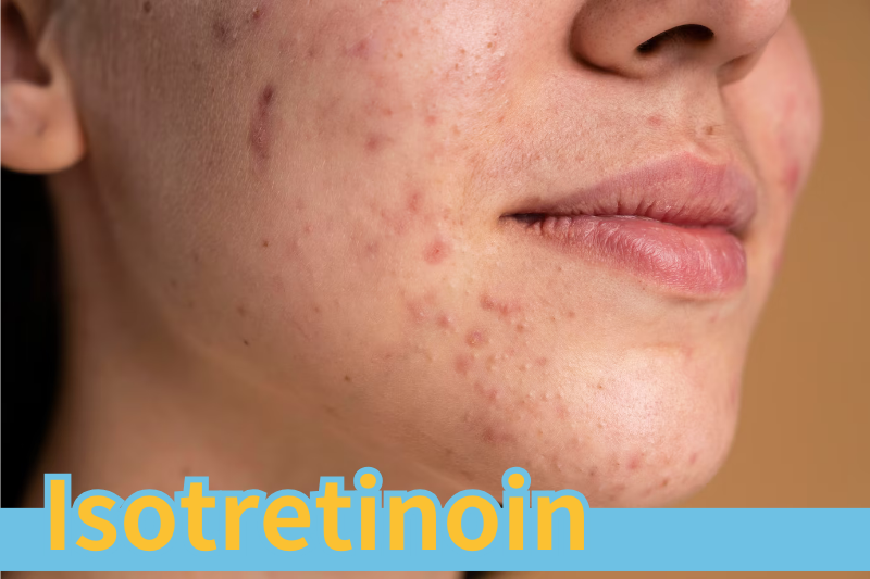 Read more about the article Isotretinoin